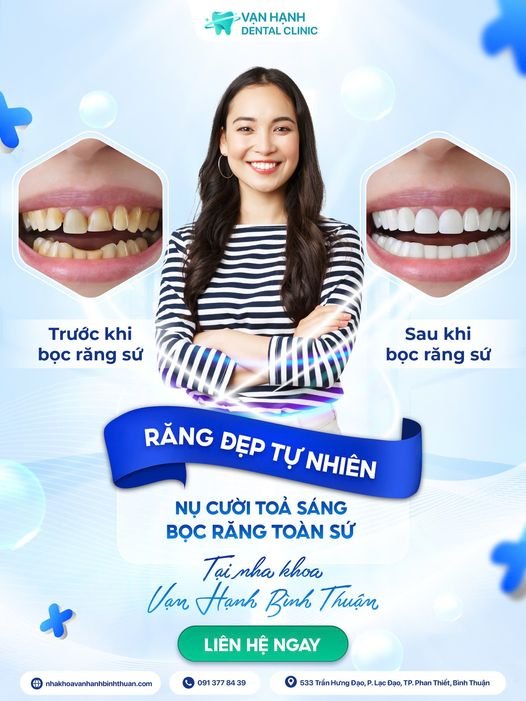 RĂNG ĐẸP TỰ NHIÊN, NỤ CƯỜI TOẢ SÁNG KHI BỌC RĂNG TOÀN SỨ TẠI NHA KHOA VẠN HẠNH BÌNH THUẬN
