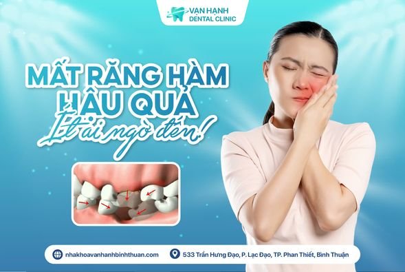 MẤT RĂNG HÀM - HẬU QUẢ ÍT AI NGỜ ĐẾN!