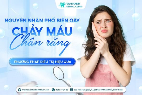 NGUYÊN NHÂN PHỔ BIẾN GÂY CHẢY MÁU CHÂN RĂNG VÀ PHƯƠNG PHÁP ĐIỀU TRỊ HIỆU QUẢ