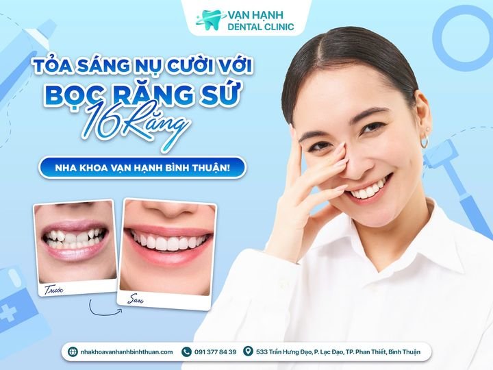 TOẢ SÁNG NỤ CƯỜI VỚI BỌC RĂNG SỨ 16 RĂNG TẠI NHA KHOA VẠN HẠNH BÌNH THUẬN