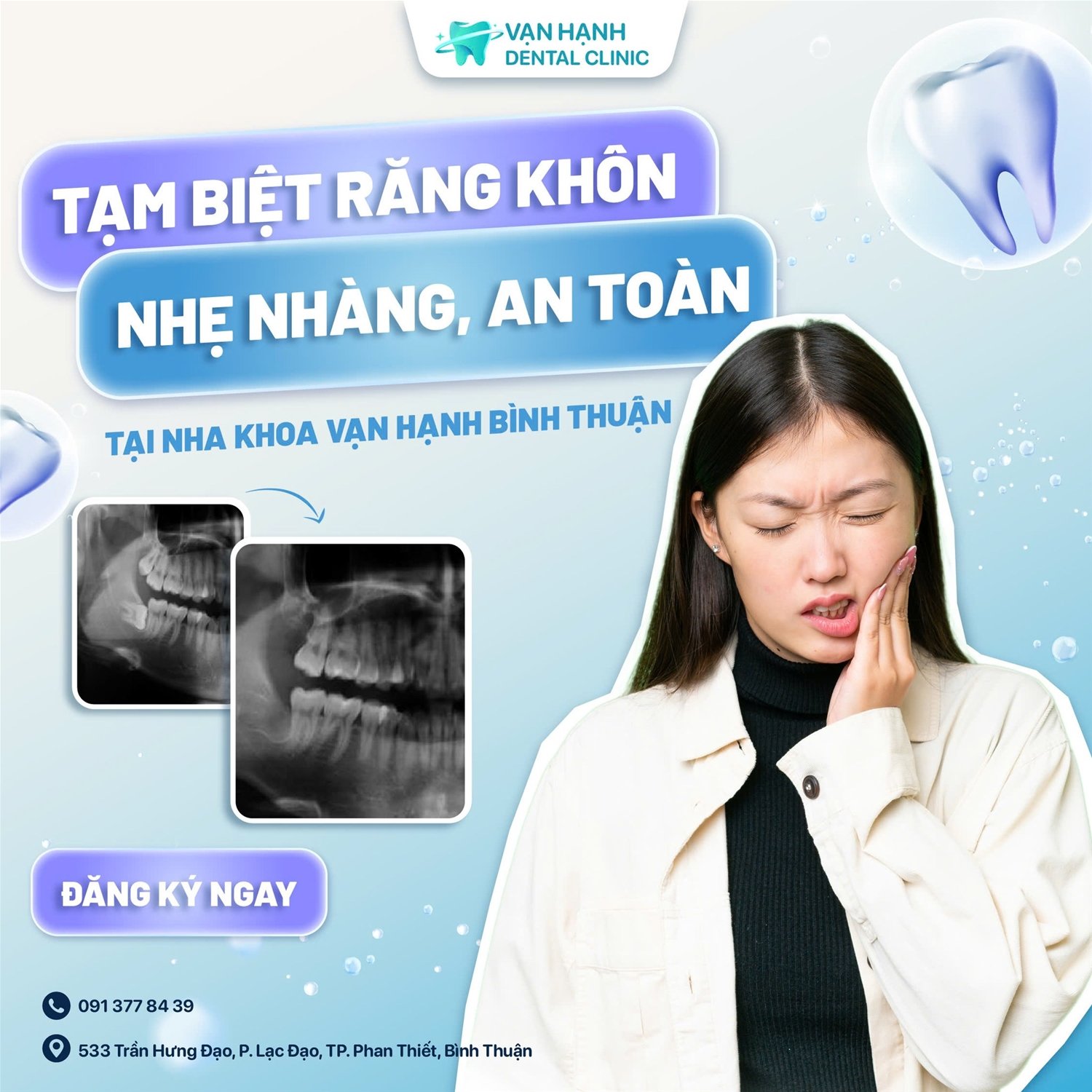TẠM BIỆT RĂNG KHÔN - NHẸ NHÀNG, AN TOÀN TẠI NHA KHOA VẠN HẠNH BÌNH THUẬN