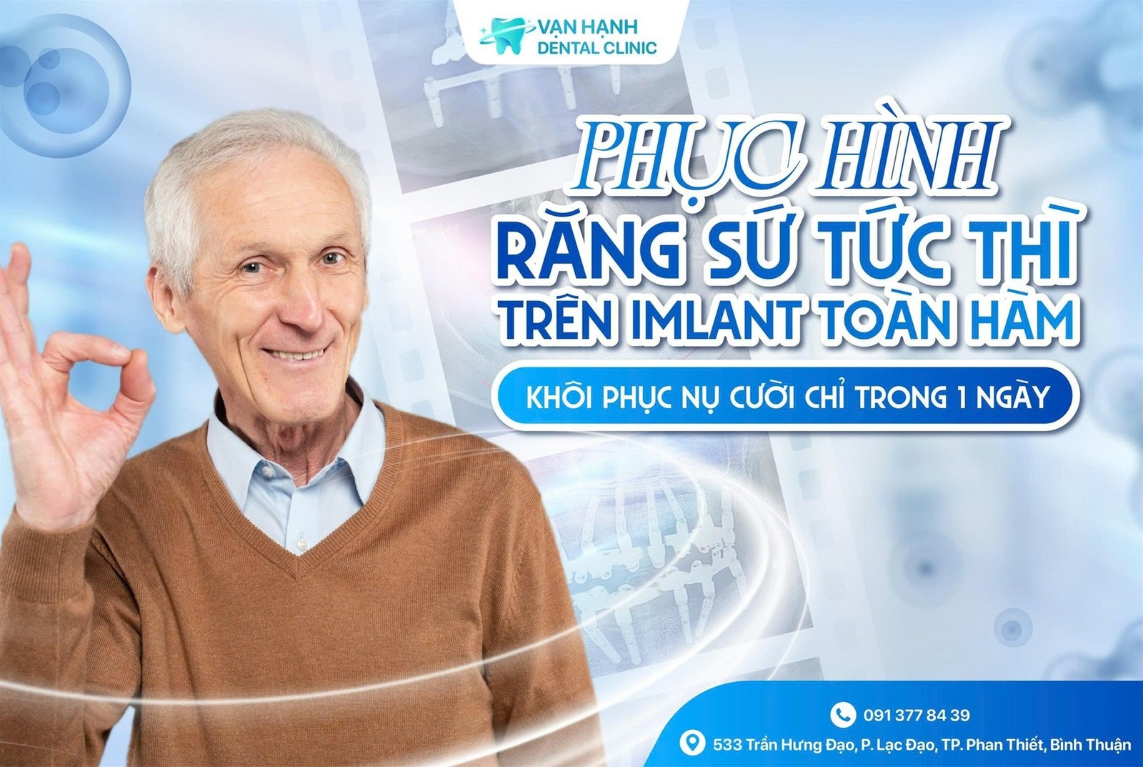 PHỤC HÌNH RĂNG SỨ TỨC THÌ TRÊN IMPLANT TOÀN HÀM - KHÔI PHỤC NỤ CƯỜI CHỈ TRONG 1 NGÀY