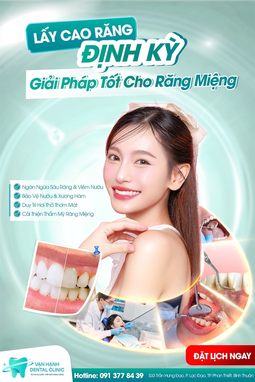 LẤY CAO RĂNG ĐỊNH KỲ - GIẢI PHÁP TỐT CHO RĂNG MIỆNG CỦA BẠN