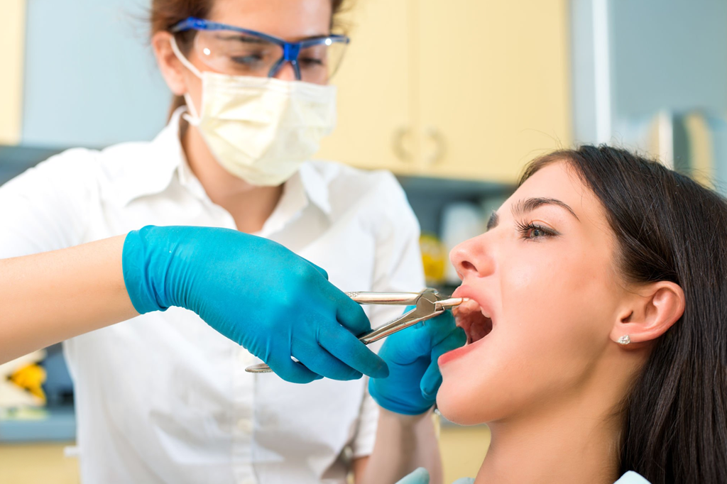 Nhổ răng - Tiểu phẫu