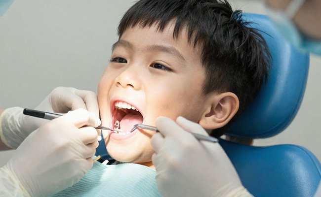 Điều trị sâu răng trẻ em
