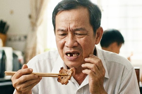 Mất răng gây khó ăn nhai