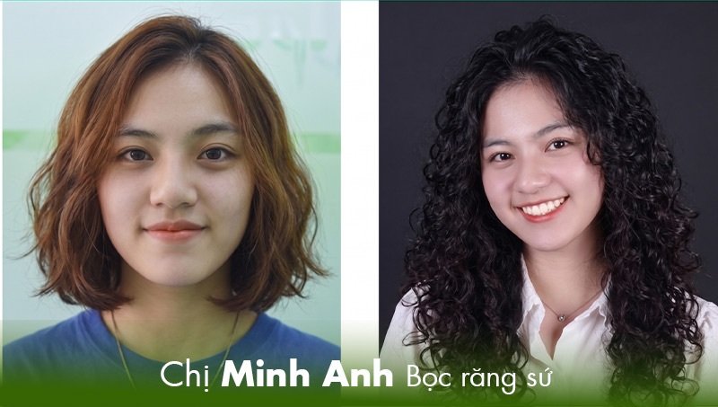 Minh Anh chia sẽ