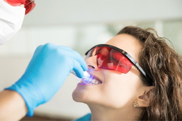 Phương pháp tẩy trắng răng bằng laser