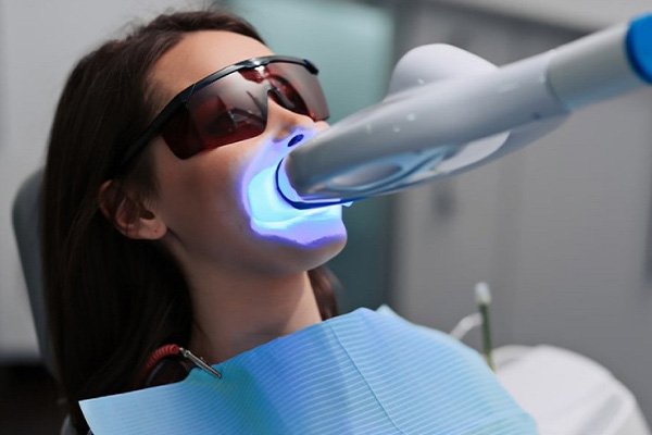 Phương pháp tẩy trắng răng bằng lplasma