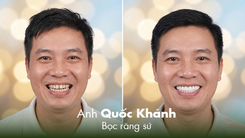 Quốc khánh chia sẻ