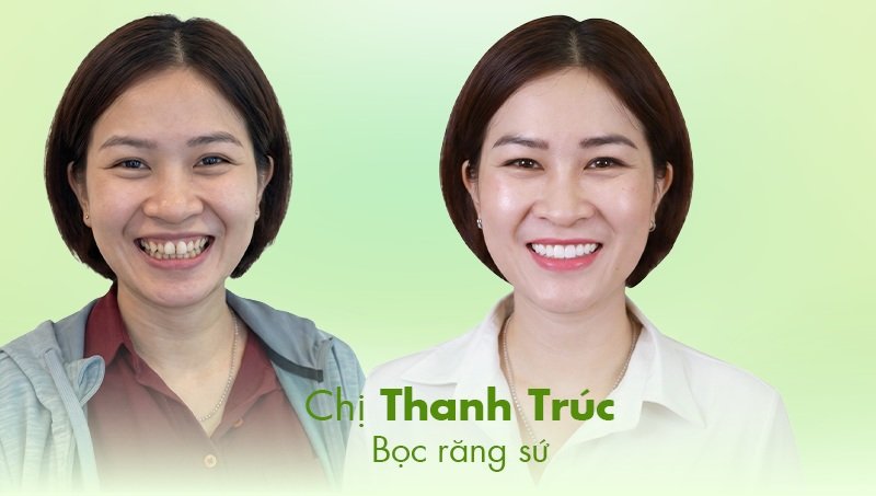Thanh trúc chia sẻ