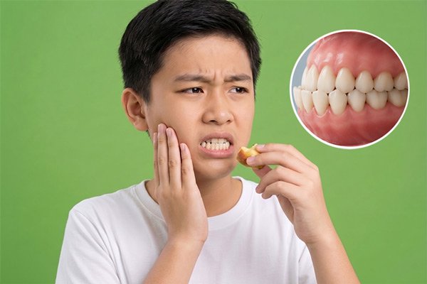 tình trạng khớp cắn sai lệch