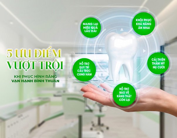 Ưu điểm vượt trội phục hình răng